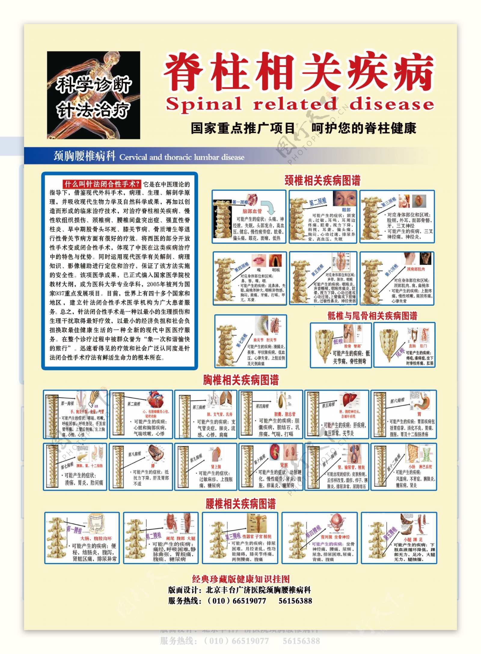 中医针刀疗法宣传展板图片