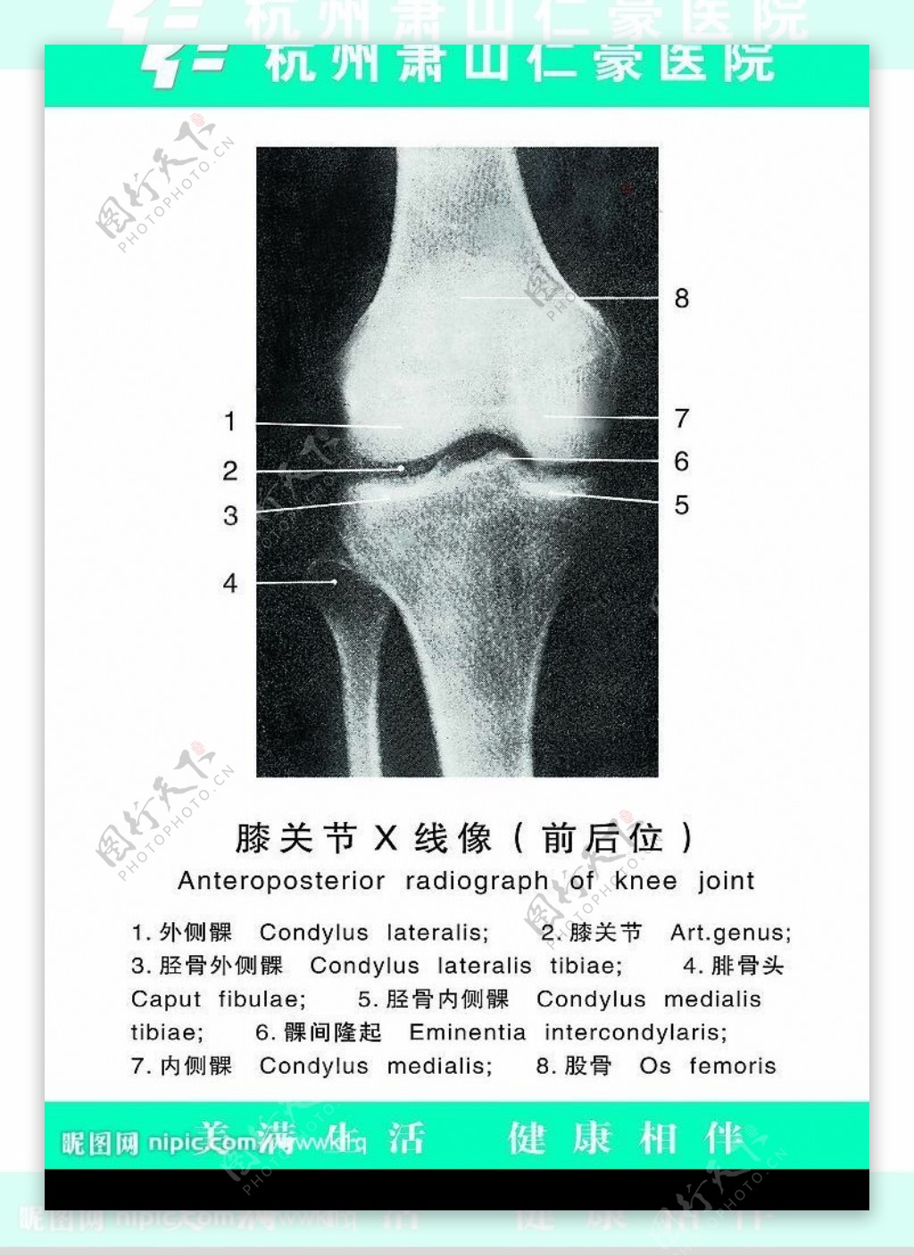 膝关节X线像图片