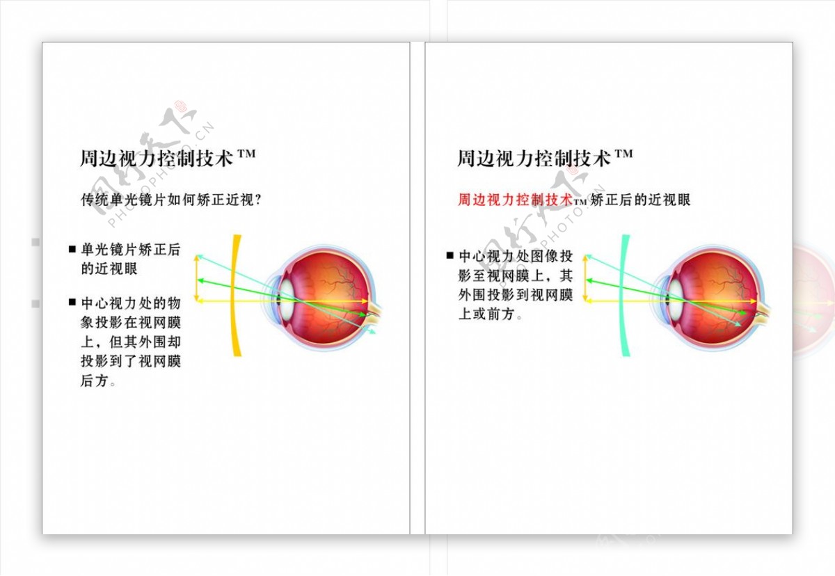 视力控制