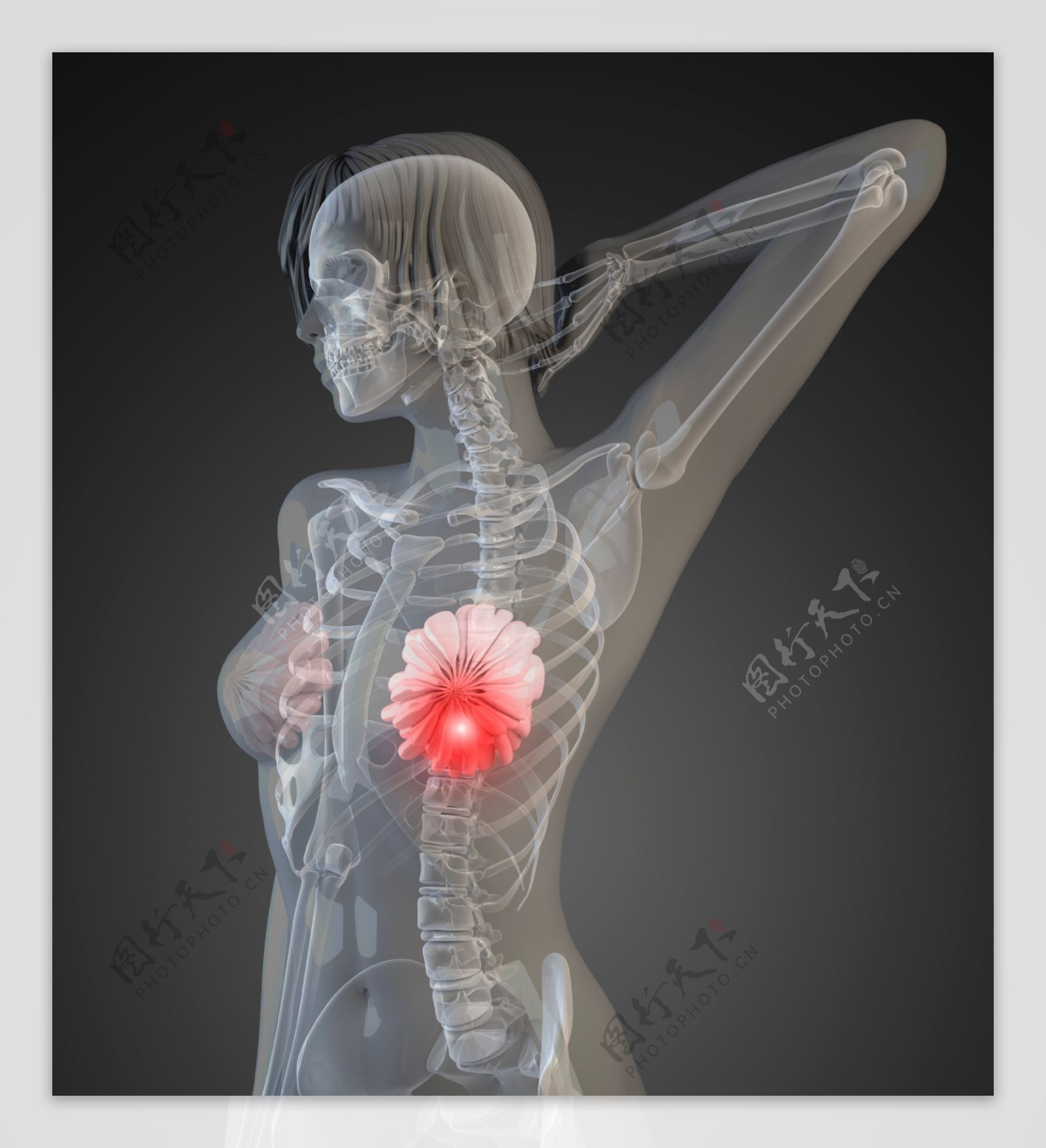 女性胸部X光透视图图片