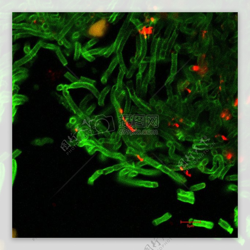 炭疽杆菌的共焦显微照片
