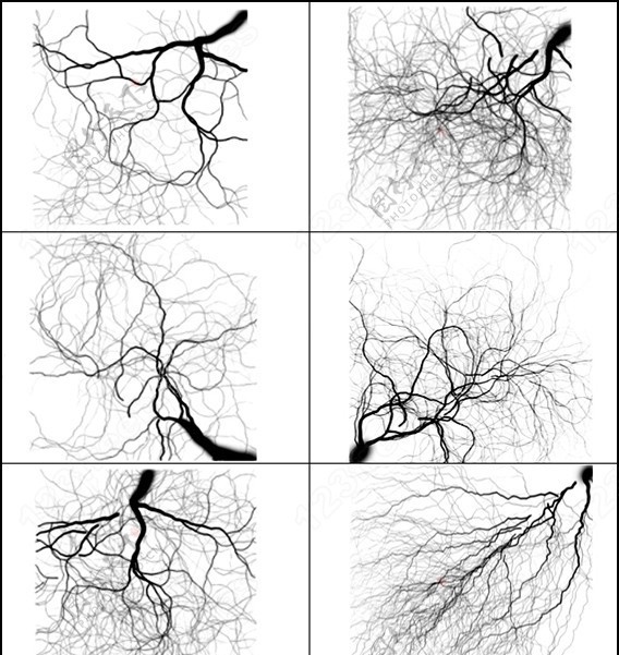 树根神经细胞闪电毛细血管笔刷