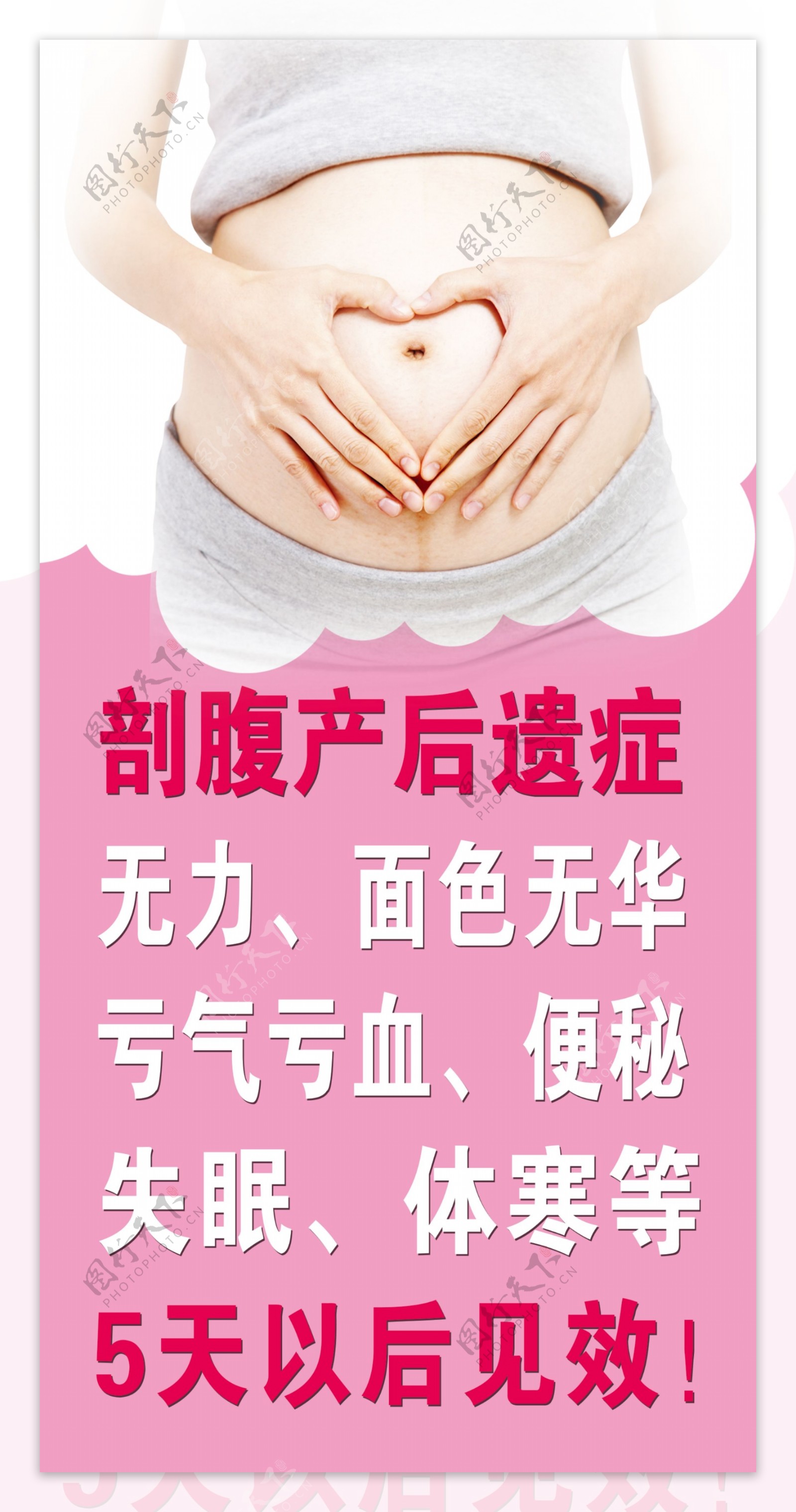 孕妇妇肚剖宫产剖腹产